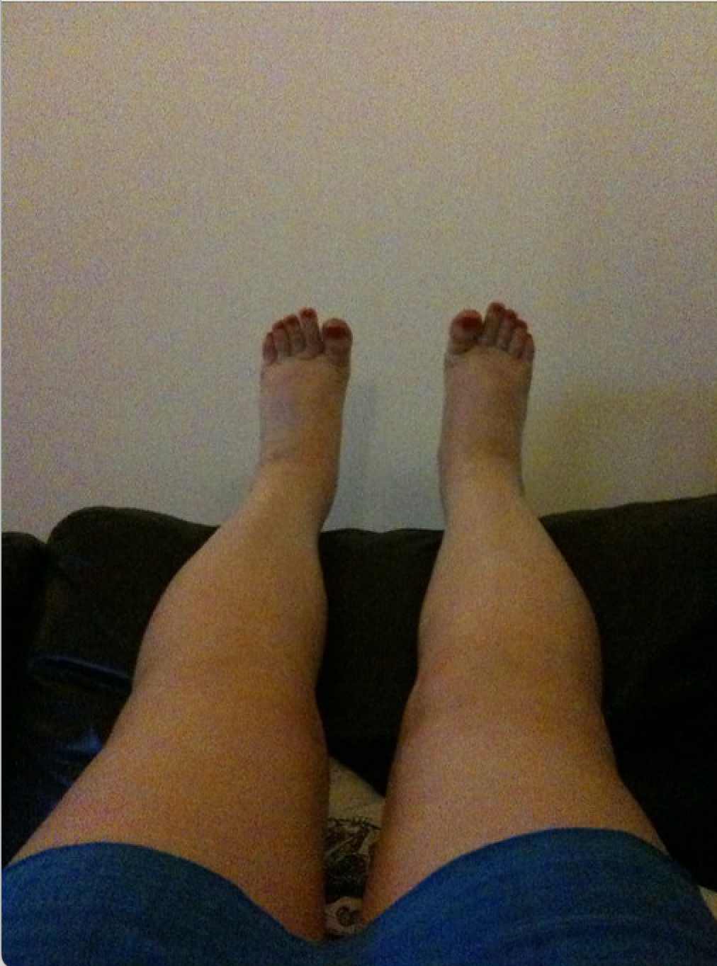 Without CompressoWear™